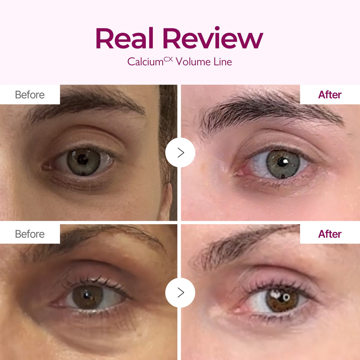 Calcium Intense Cream detail 3