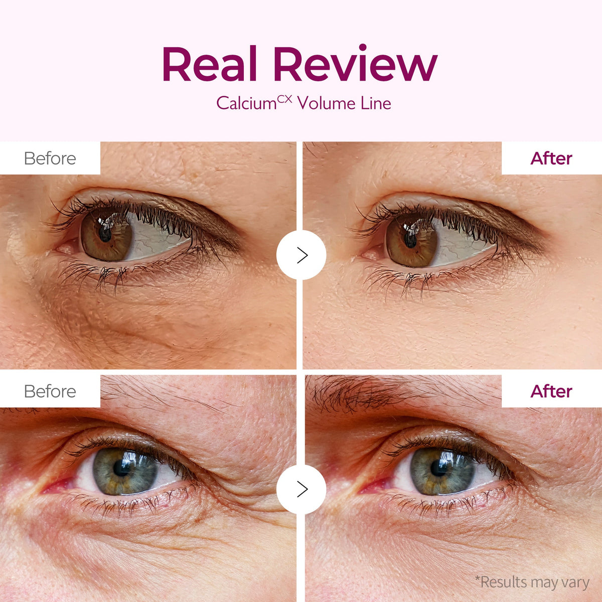 Calcium Volume Eye patch 60ea detail 3