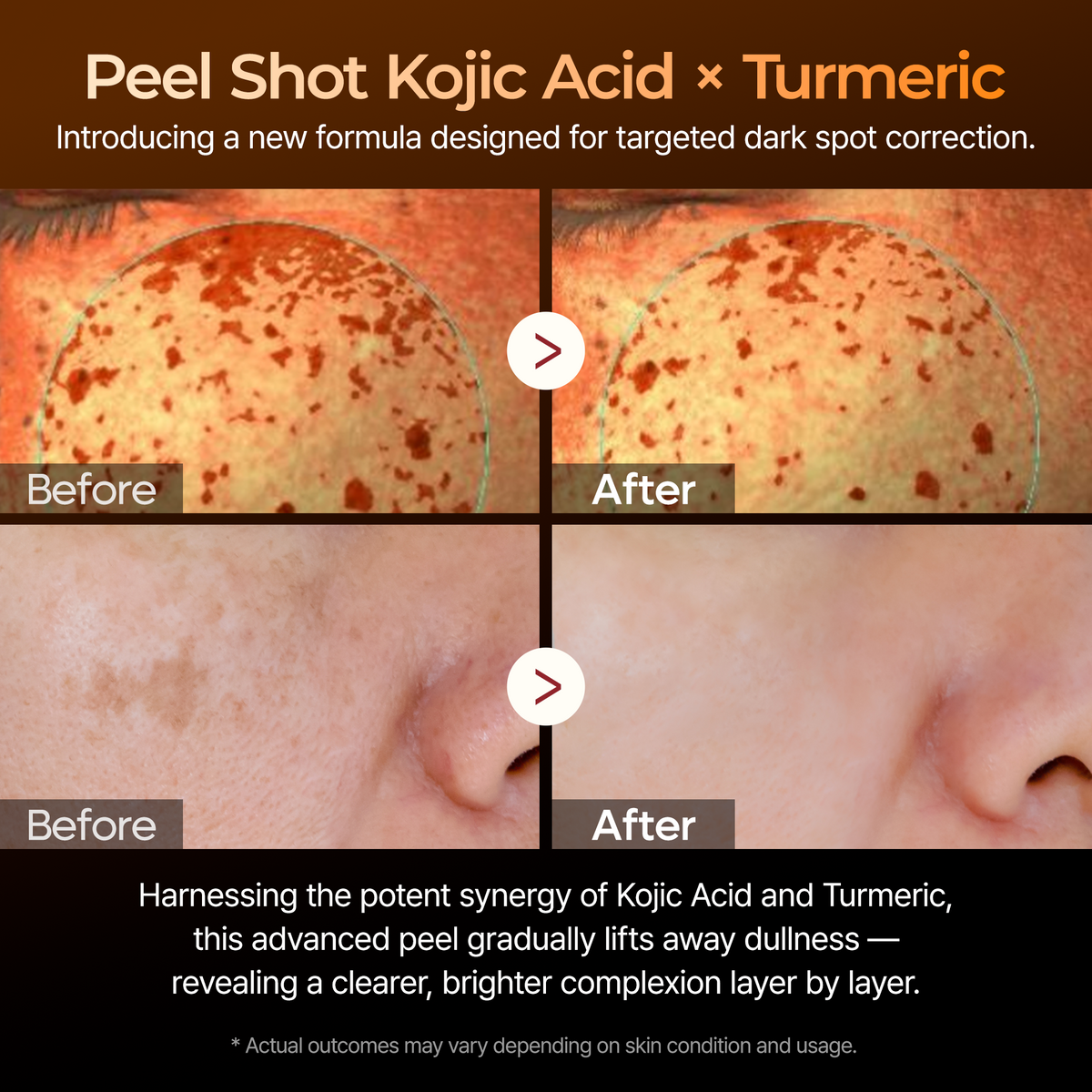 Peel Shot Kojic Acid Turmeric Serum detail 3