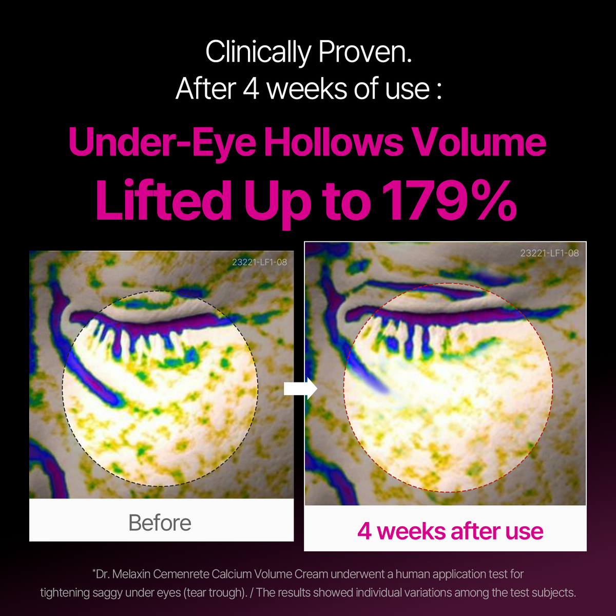Calcium Eyecare Routine Set detail 2