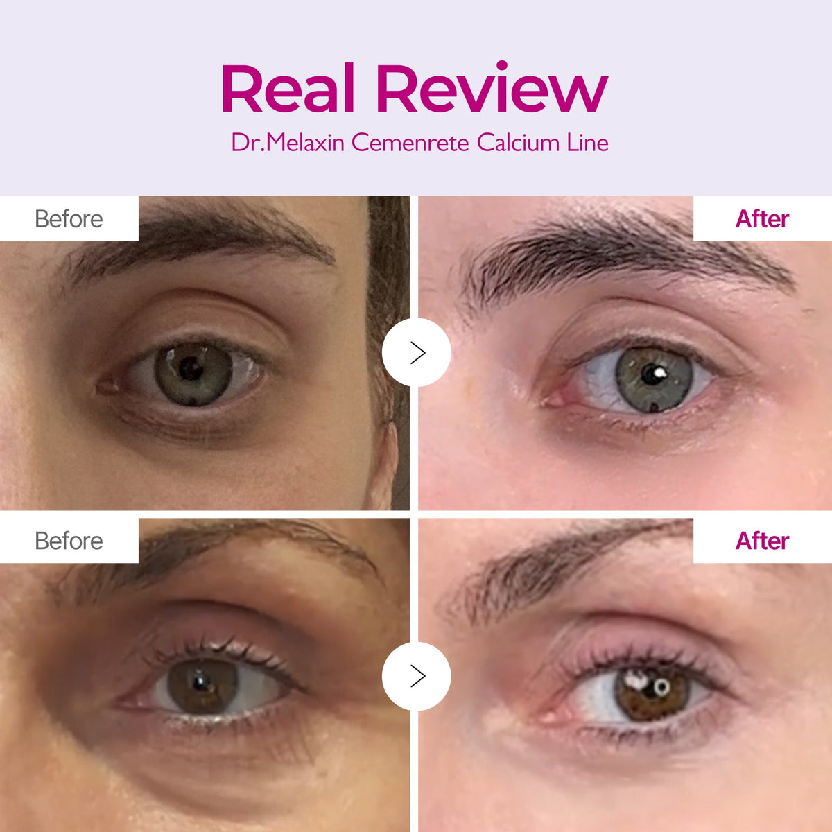Calcium Eyecare Routine Set detail 3