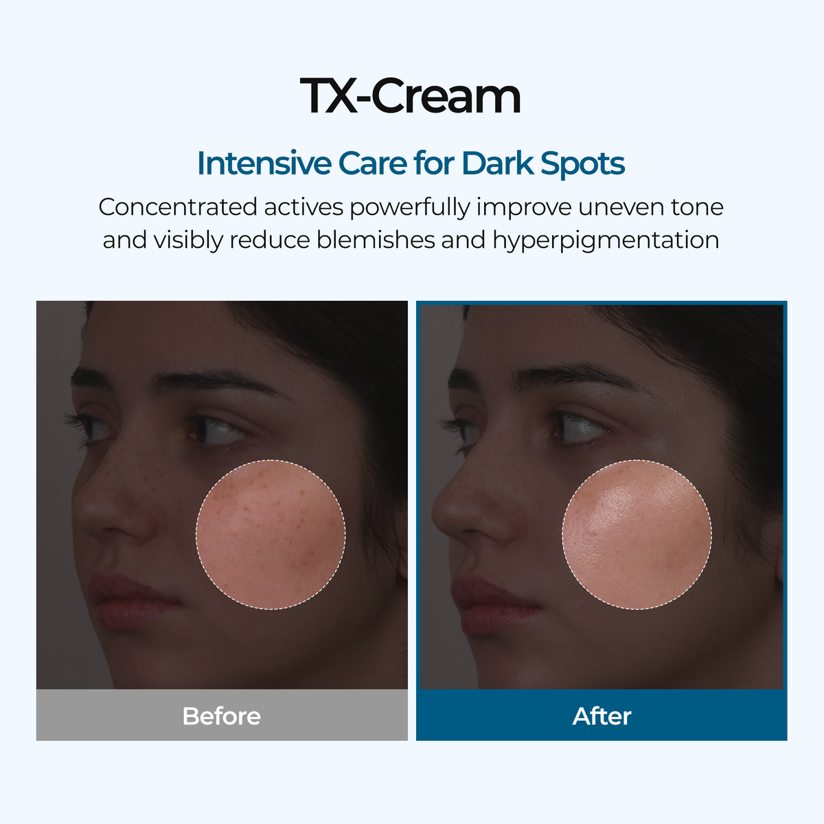 TX Cream detail 3