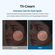 TX Cream detail 3