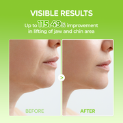 Cactox V-Lifting Mewing Band 4EA detail 6