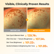 Kojic Acid Turmeric TX Toner Pad 70pads detail 3
