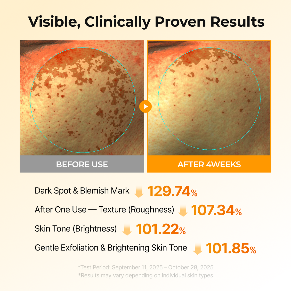 Kojic Acid Turmeric TX Toner Pad 70pads detail 3