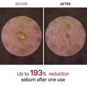 Peel Shot Glow Black Rice Ampoule detail 4