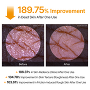 Body & Face Peel Shot Duo detail 7