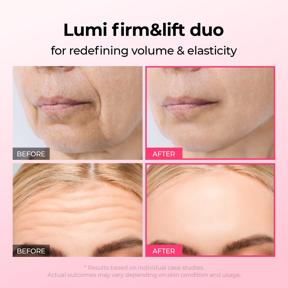 [TikTok Bestseller] Lumi firm & lift Duo detail 2